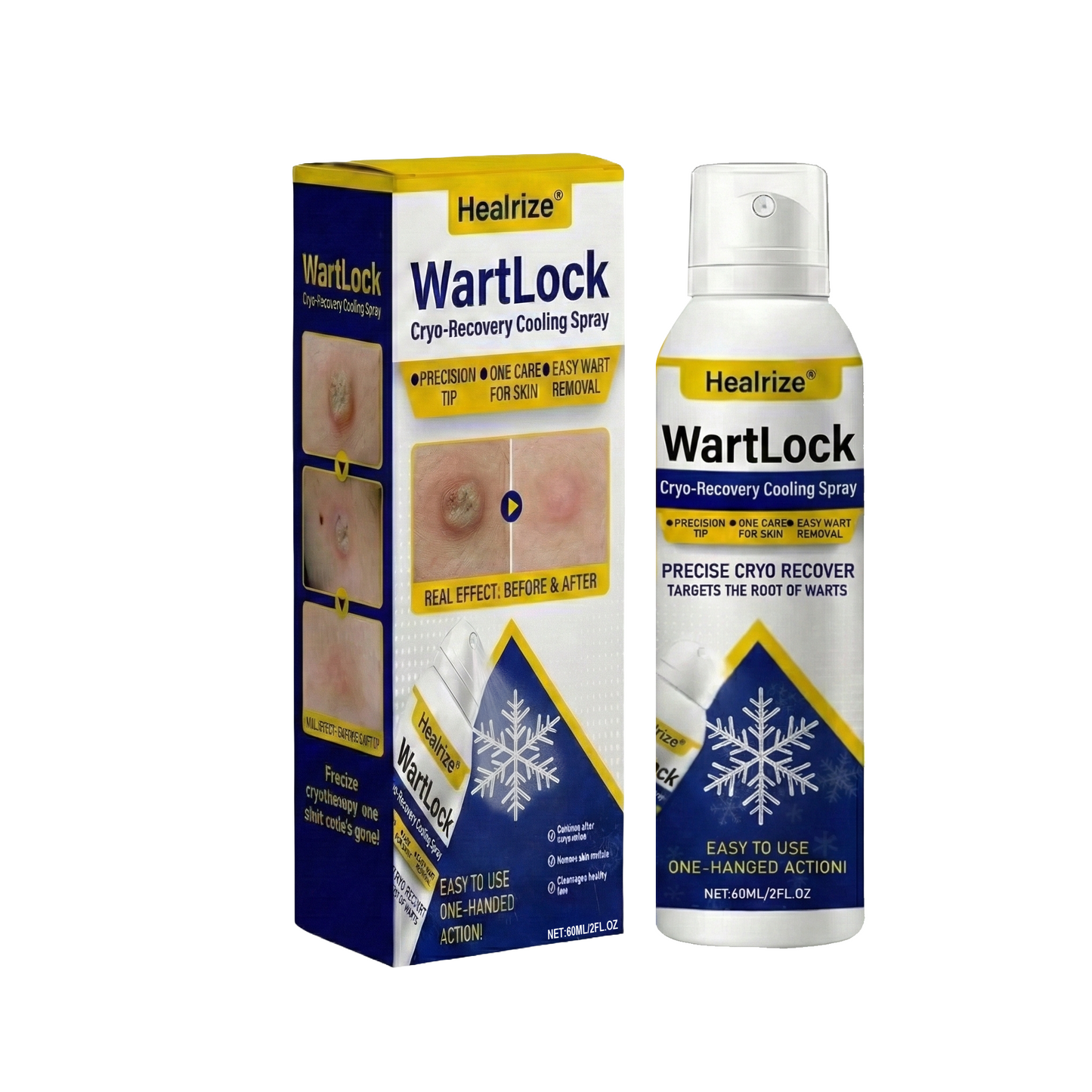 🔥𝙇𝙞𝙢𝙞𝙩𝙚𝙙-𝙩𝙞𝙢𝙚 𝙊𝙛𝙛𝙚𝙧 | Healrize® WartLock Cryo-Recovery Cooling Spray