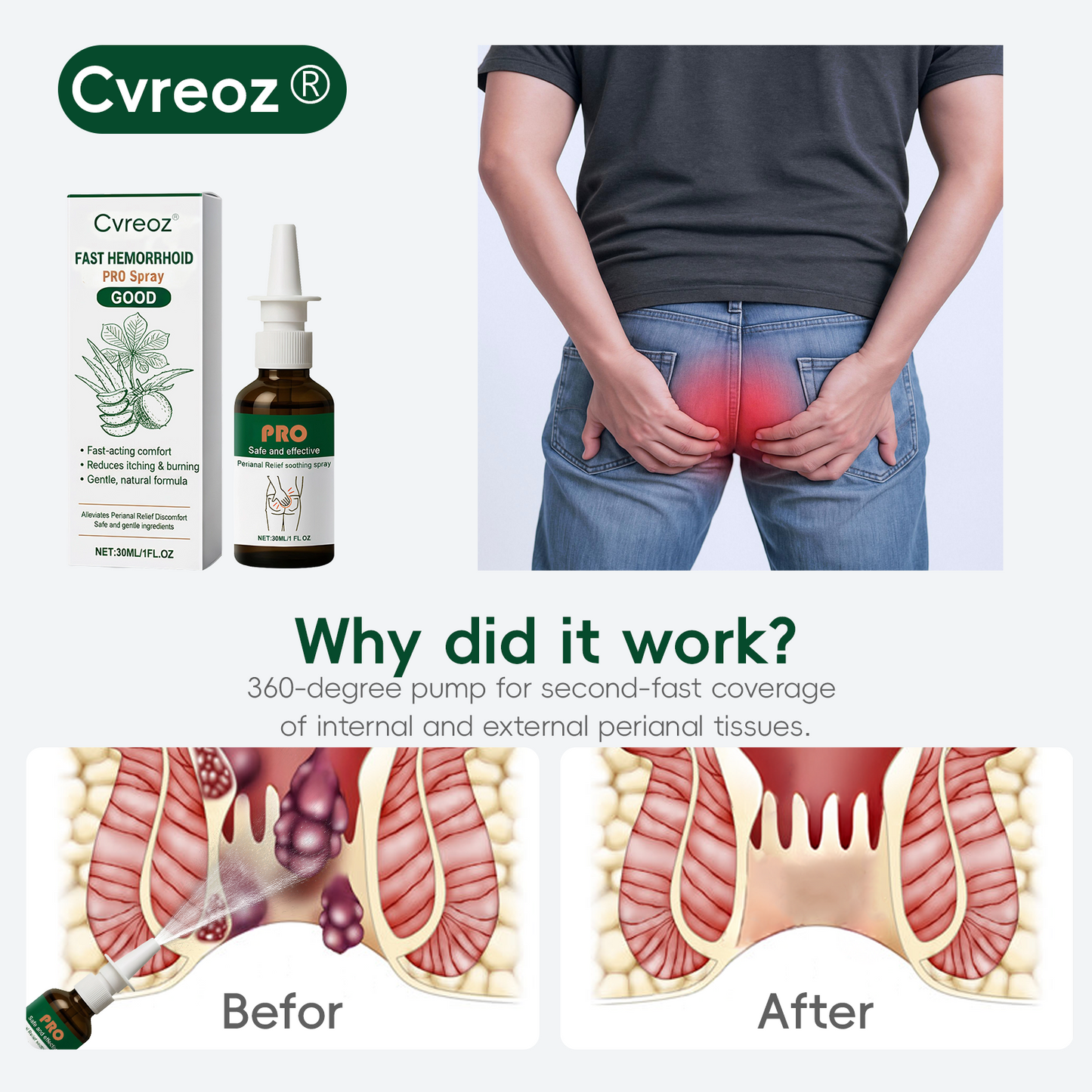🎁𝐄𝐚𝐬𝐭𝐞𝐫 𝐒𝐚𝐥𝐞 | Cvreoz® Fast Hemorrhoid PRO Spray
