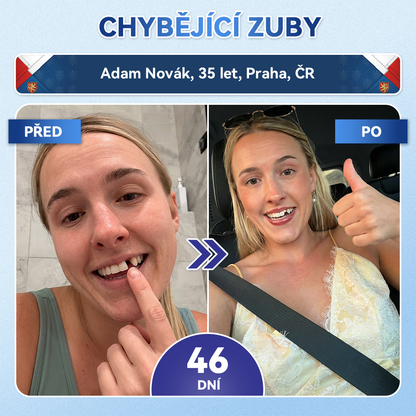 🦷Glimmerly® Microneedle naplast pro opravu zubi a dasni s Tideglusibem  |Pokročilé zubní pásky s aktivací kmenových buněk (obnovuje sklovinu a dentin • posiluje dásně • odstraňuje plak a zápach • zastavuje citlivost zubů) 3.0