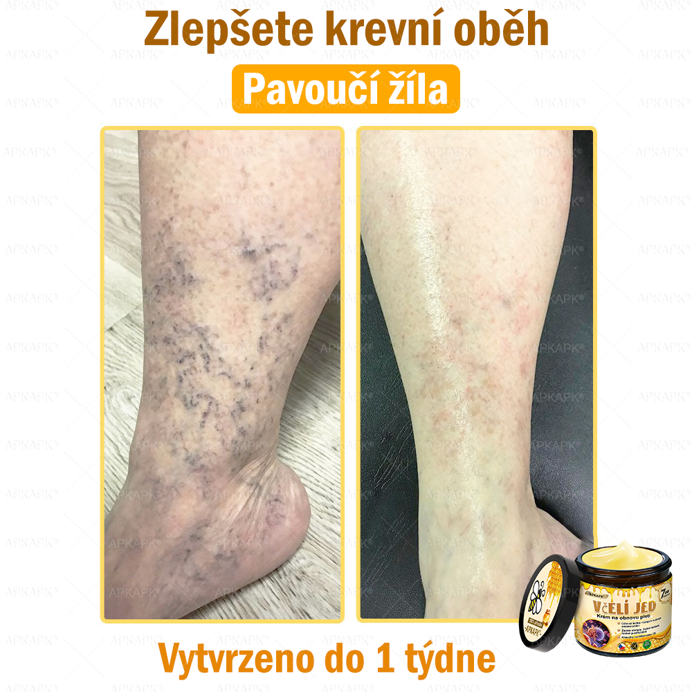 🐝Dermatologicky a klinicky testováno👩‍⚕️APKAPK®Bee Venom Krém na obnovení pleti🐝 pomáhá při léčbě kožních problémů, jako jsou: vrásky, jizvy, pigmentové skvrny, strie, akné, psoriáza, ekzém, kožní změny, podráždění, záněty a další kožní problémy.