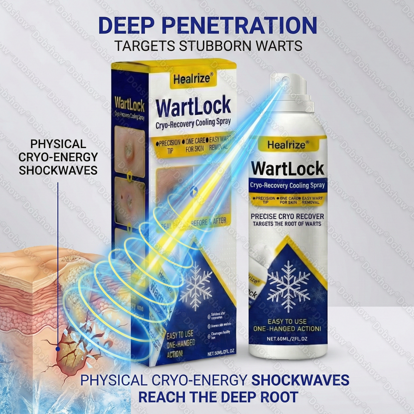 🏅𝙏𝙂𝘼 𝘼𝙥𝙥𝙧𝙤𝙫𝙚𝙙 | Healrize® WartLock Cryo-Recovery Cooling Spray