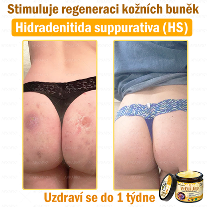 🐝Dermatologicky a klinicky testováno👩‍⚕️APKAPK®Bee Venom Krém na obnovení pleti🐝 pomáhá při léčbě kožních problémů, jako jsou: vrásky, jizvy, pigmentové skvrny, strie, akné, psoriáza, ekzém, kožní změny, podráždění, záněty a další kožní problémy.