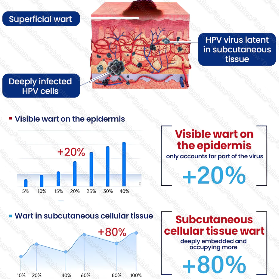 🔥𝙇𝙞𝙢𝙞𝙩𝙚𝙙-𝙩𝙞𝙢𝙚 𝙊𝙛𝙛𝙚𝙧 | Healrize® WartLock Cryo-Recovery Cooling Spray