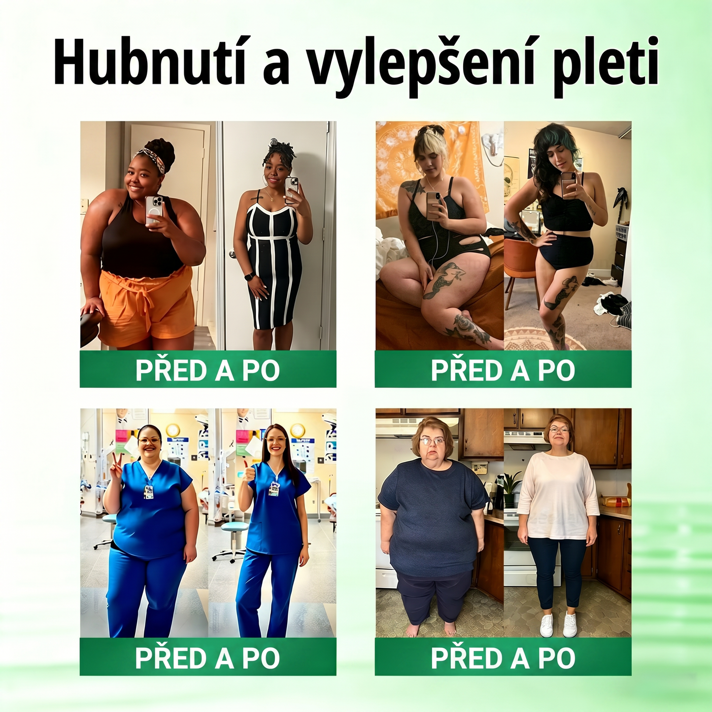 🌿Luxarise®Glumasetide 8v1 Stihla a zdrava nano mikrojehlickova naplast(1krát denně – viditelné změny až za 7 dní) ✅Pro obezitu, zpevnění kůže, cukrovku, spánkovou apnoe, klouby atd.