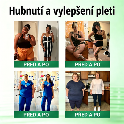 🌿Luxarise®Glumasetide 8v1 Stihla a zdrava nano mikrojehlickova naplast(1krát denně – viditelné změny až za 7 dní) ✅Pro obezitu, zpevnění kůže, cukrovku, spánkovou apnoe, klouby atd.