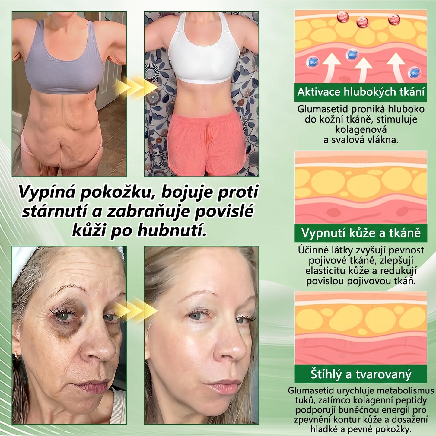 🌿Luxarise®Glumasetide 8v1 Stihla a zdrava nano mikrojehlickova naplast(1krát denně – viditelné změny až za 7 dní) ✅Pro obezitu, zpevnění kůže, cukrovku, spánkovou apnoe, klouby atd.