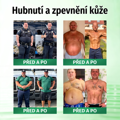 🌿Luxarise®Glumasetide 8v1 Stihla a zdrava nano mikrojehlickova naplast(1krát denně – viditelné změny až za 7 dní) ✅Pro obezitu, zpevnění kůže, cukrovku, spánkovou apnoe, klouby atd.