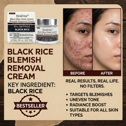 🏅𝙏𝙂𝘼 𝘼𝙥𝙥𝙧𝙤𝙫𝙚𝙙 | Healrize® Black Rice Dual-Action Blemish Removal Cream