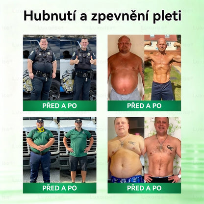 Oficiální obchod  |👩‍⚕️𝗟𝘂𝘅𝗮𝗿𝗶𝘀𝗲® MORINGA X BERBERIN  10-IN-1 Pokročilý Nano Mikrojehly Náplast(Jedna náplast denně, viditelné změny již za 7 dní) ✅ Pomáhá při obezitě, cukrovce, spánkové apnoe, problémech s klouby a dalších potížích💫