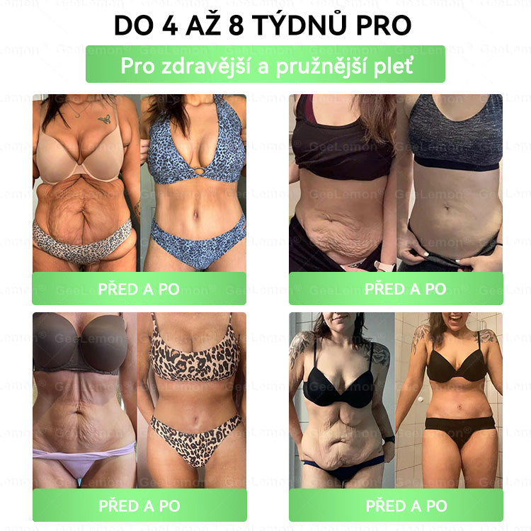 𝐆𝐞𝑒𝑙𝑒𝐦𝐨𝐧® 😺Glum𝐚𝐬𝐞tide 8 v 1 – Zeštíhlující nano mikrojihlový náplast 🇨🇿 Jen 1× denně ✅ Viditelné změny za 7 dní – na obezitu, kardiovaskulární zdraví, diabetes a kloubní problémy