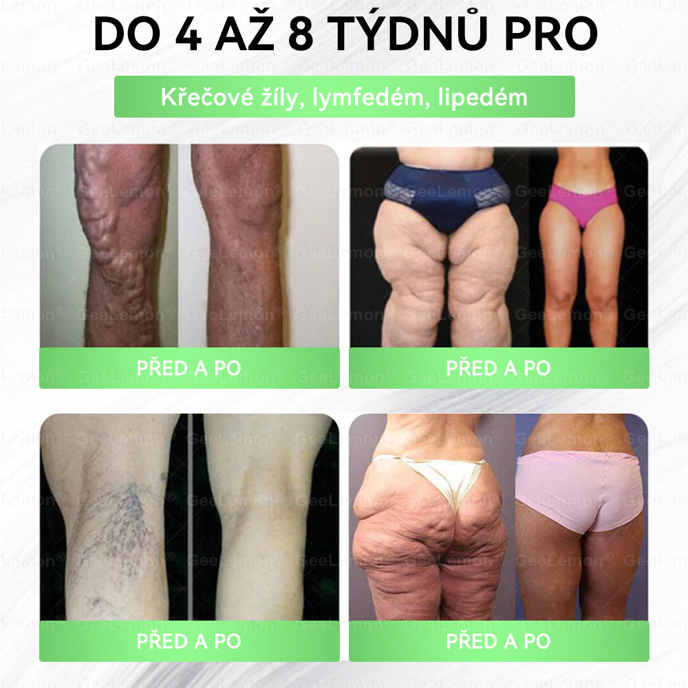 𝐆𝐞𝑒𝑙𝑒𝐦𝐨𝐧® 😺Glum𝐚𝐬𝐞tide 8 v 1 – Zeštíhlující nano mikrojihlový náplast 🇨🇿 Jen 1× denně ✅ Viditelné změny za 7 dní – na obezitu, kardiovaskulární zdraví, diabetes a kloubní problémy