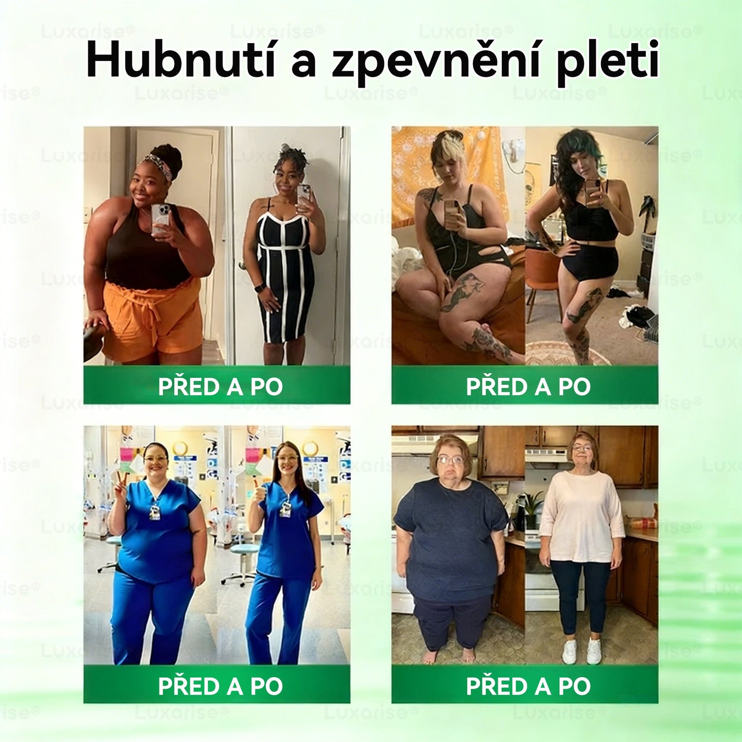 Oficiální obchod  |👩‍⚕️𝗟𝘂𝘅𝗮𝗿𝗶𝘀𝗲® MORINGA X BERBERIN  10-IN-1 Pokročilý Nano Mikrojehly Náplast(Jedna náplast denně, viditelné změny již za 7 dní) ✅ Pomáhá při obezitě, cukrovce, spánkové apnoe, problémech s klouby a dalších potížích💫