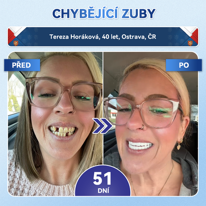 🦷Glimmerly® Microneedle naplast pro opravu zubi a dasni s Tideglusibem  |Pokročilé zubní pásky s aktivací kmenových buněk (obnovuje sklovinu a dentin • posiluje dásně • odstraňuje plak a zápach • zastavuje citlivost zubů) 3.0