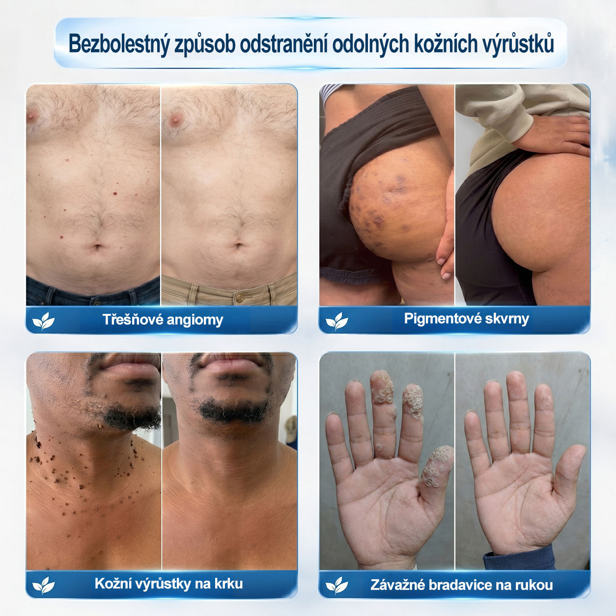 ✅✨𝐎𝐟𝐢𝐜𝐢á𝐥𝐧í 𝐳𝐧𝐚č𝐤𝐨𝐯á 𝐩𝐫𝐨𝐝𝐞𝐣𝐧𝐚  𝐏𝐢𝐜𝐝𝐨® 𝟕𝐝𝐞𝐧𝐧í 𝐨𝐝𝐬𝐭𝐫𝐚ň𝐨𝐯𝐚č   𝐤𝐨ž𝐧í𝐜𝐡 𝐯ý𝐫ů𝐬𝐭𝐤ů 𝐚 𝐬𝐤𝐯𝐫𝐧(Nulová bolest, nulová kulička Rollerball)