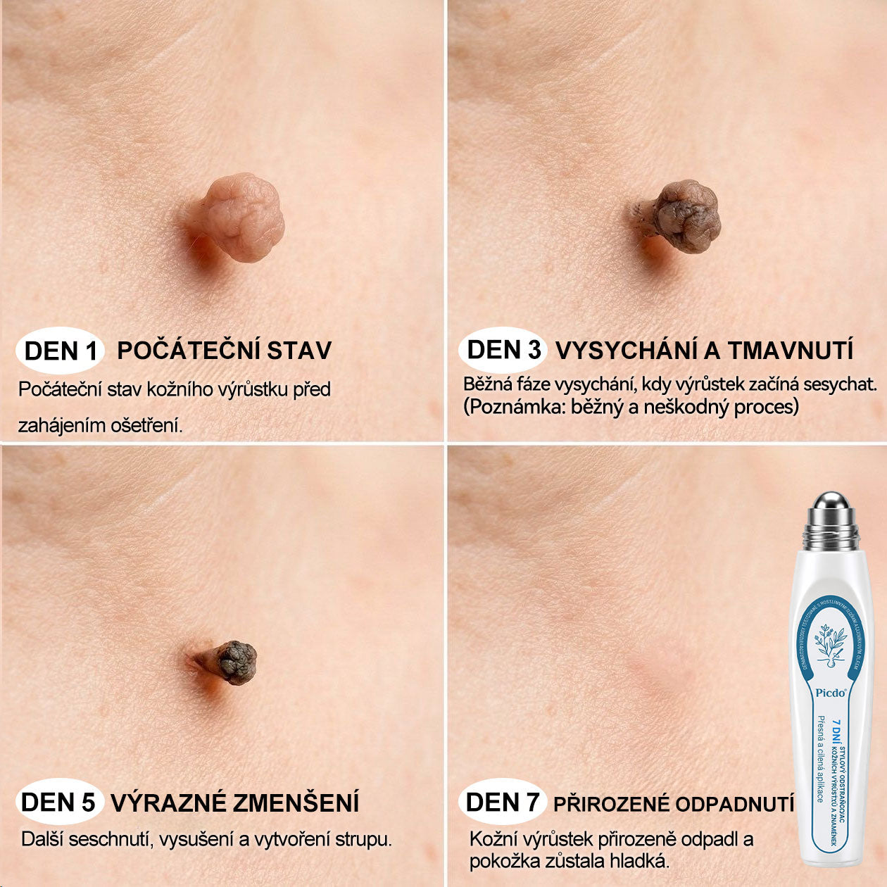 ✅✨𝐎𝐟𝐢𝐜𝐢á𝐥𝐧í 𝐳𝐧𝐚č𝐤𝐨𝐯á 𝐩𝐫𝐨𝐝𝐞𝐣𝐧𝐚  𝐏𝐢𝐜𝐝𝐨® 𝟕𝐝𝐞𝐧𝐧í 𝐨𝐝𝐬𝐭𝐫𝐚ň𝐨𝐯𝐚č   𝐤𝐨ž𝐧í𝐜𝐡 𝐯ý𝐫ů𝐬𝐭𝐤ů 𝐚 𝐬𝐤𝐯𝐫𝐧(Nulová bolest, nulová kulička Rollerball)