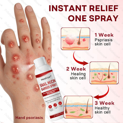 🔥𝙈𝙖𝙧𝙘𝙝 𝙎𝙥𝙚𝙘𝙞𝙖𝙡 𝙊𝙛𝙛𝙚𝙧𝙨 | Healrize® Snail Mucin Barrier Spray for Flare-Up Relief & Skin Repair