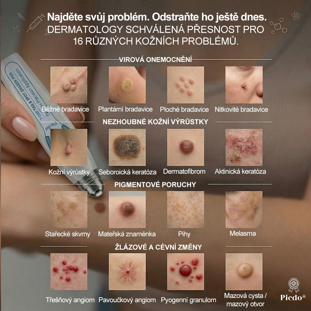 ✅✨𝐎𝐟𝐢𝐜𝐢á𝐥𝐧í 𝐳𝐧𝐚č𝐤𝐨𝐯á 𝐩𝐫𝐨𝐝𝐞𝐣𝐧𝐚  𝐏𝐢𝐜𝐝𝐨® 𝟕𝐝𝐞𝐧𝐧í 𝐨𝐝𝐬𝐭𝐫𝐚ň𝐨𝐯𝐚č   𝐤𝐨ž𝐧í𝐜𝐡 𝐯ý𝐫ů𝐬𝐭𝐤ů 𝐚 𝐬𝐤𝐯𝐫𝐧(Nulová bolest, nulová kulička Rollerball)