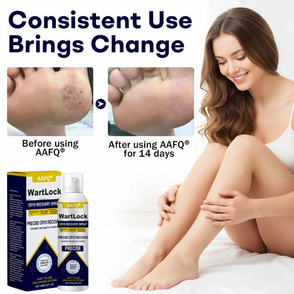 🎅 𝘾𝙝𝙧𝙞𝙨𝙩𝙢𝙖𝙨 𝙎𝙖𝙡𝙚 | AAFQ® WartLock CRYO RECOVERY SPRAY